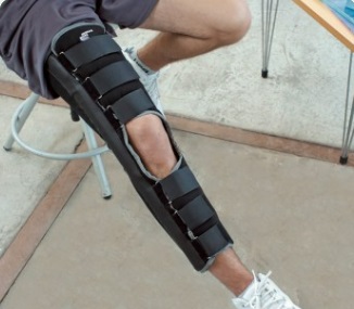 INMOBILIZADOR LARGO DE PIERNA TL